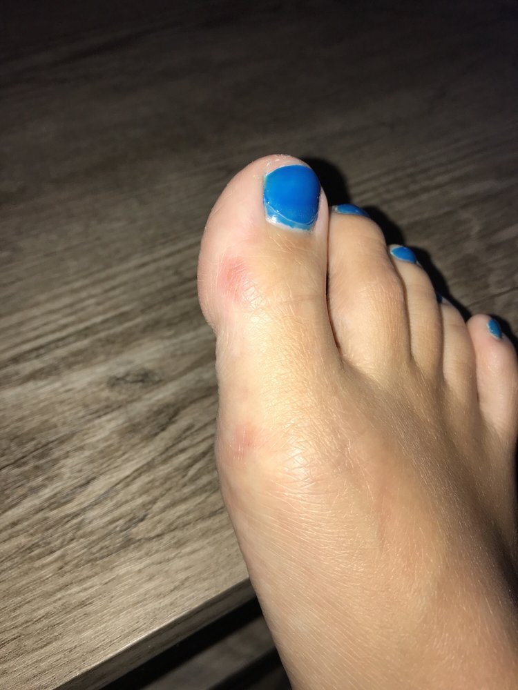 O