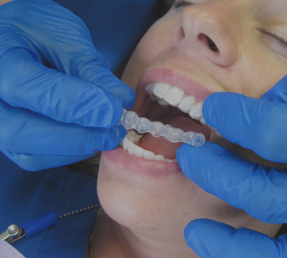 Hammerlee Dental Care 14 Photos General Dentistry 5158 Peach St