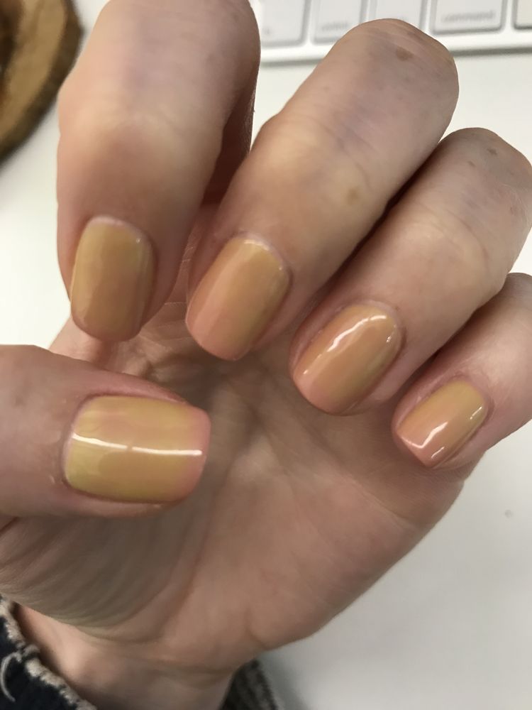 Gel Nails Discoloration Best Nail Designs 2018 Gel Nails Discoloration Best Nail Designs 2018