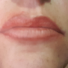 Ms