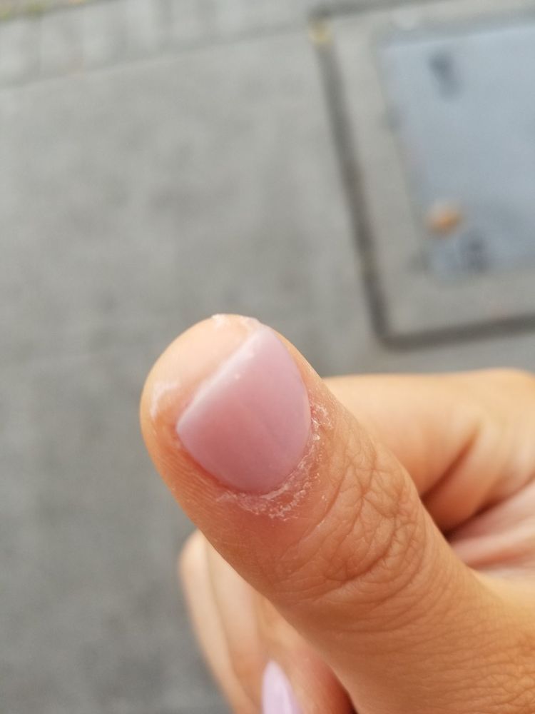 O