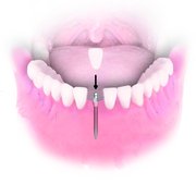 3 Stone Dental 21 Photos Cosmetic Dentists 367 Washington St Dr Syed Photo Of 3 Stone Dental Claremont Nh United States