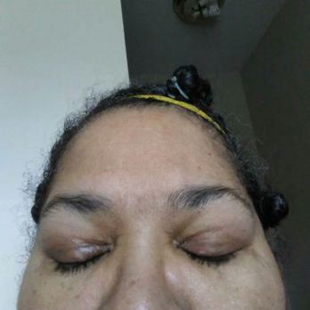 shiley eye institute at
