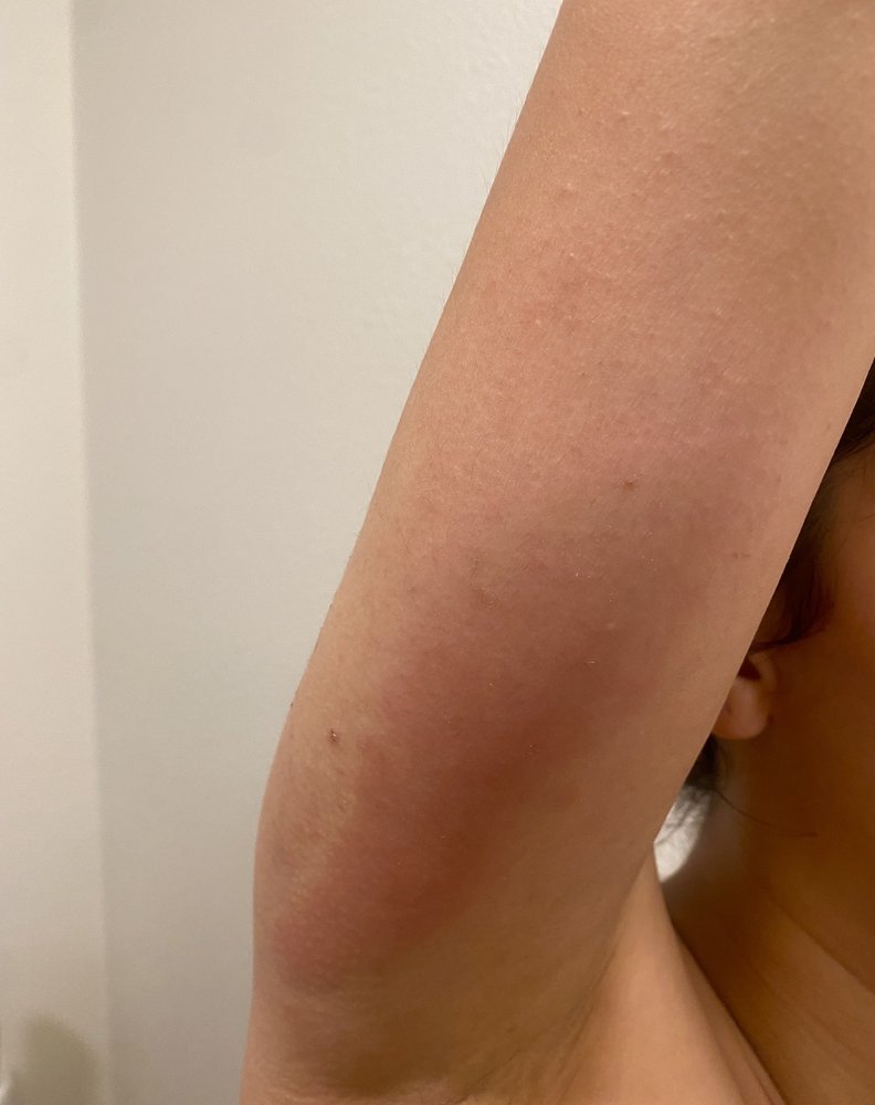 image of business Allergy & Asthma Consultants - Redwood City