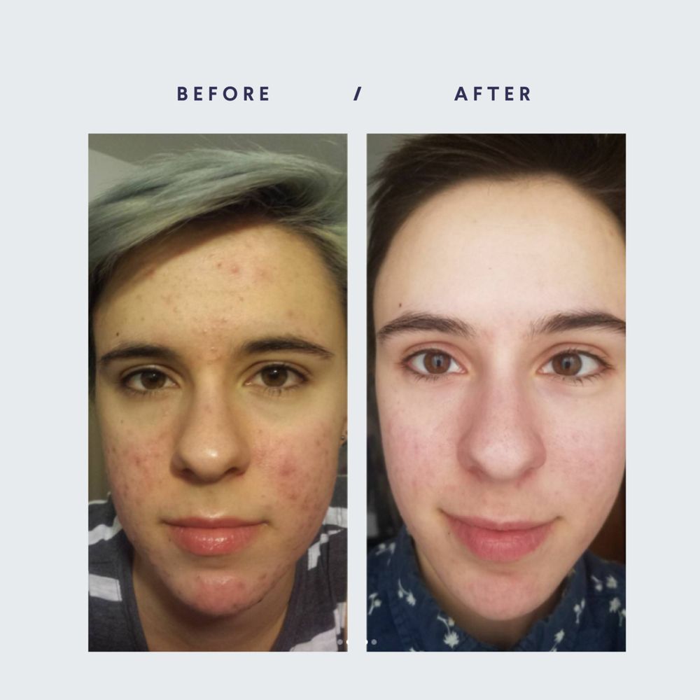 amazing results in one