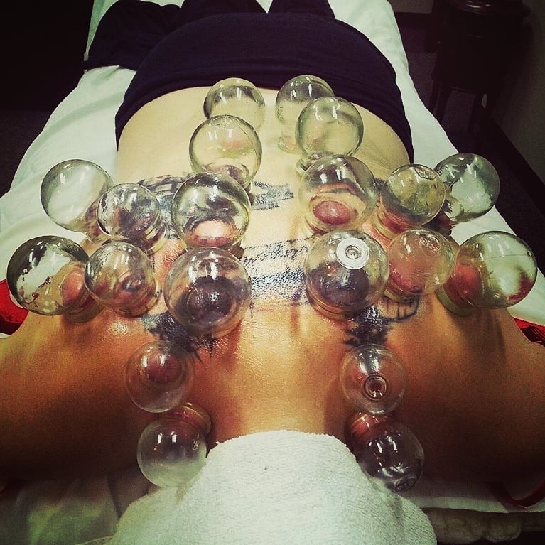 Best health option acupuncture wellness rivercrest drive germantown wi