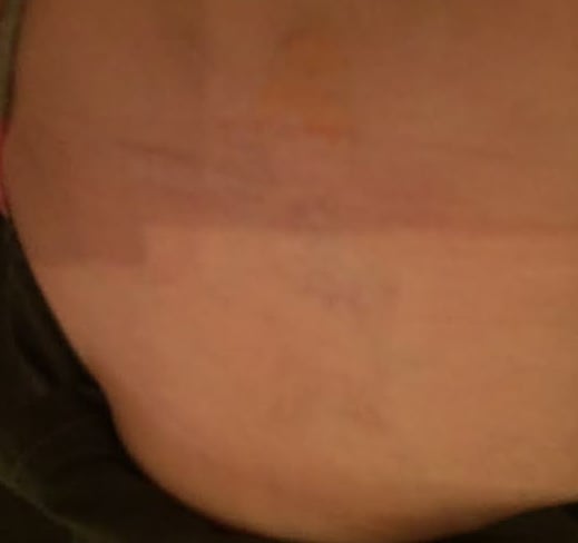 what were you inking denver tattoo removal 15 reviews tattoo what were you inking denver tattoo removal 15 reviews tattoo