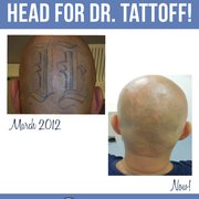 dr tattoff beverly hills closed 64 photos u0026 186 reviews dr tattoff beverly hills closed 64 photos u0026 186 reviews