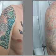 clear out ink laser tattoo removal 42 photos u0026 17 reviews clear out ink laser tattoo removal 42 photos u0026 17 reviews