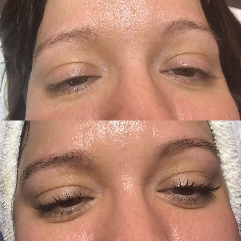Honey Skin Spa