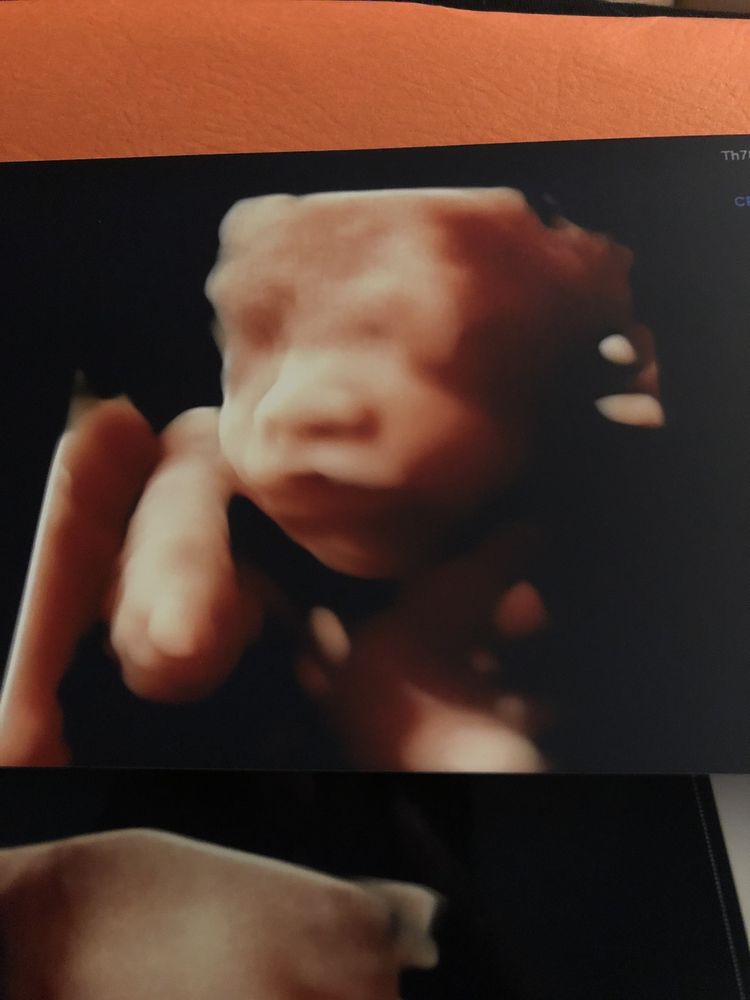 Motherhood Ultrasound
