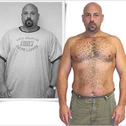 Can you lose weight after breast implants photo 1