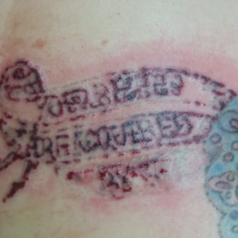 cosmeticefx closed 169 photos u0026 24 reviews tattoo removal cosmeticefx closed 169 photos u0026 24 reviews tattoo removal