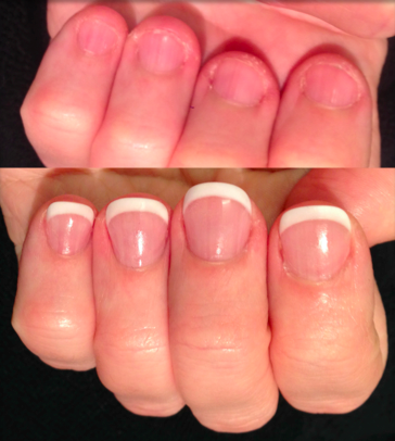 Before Bitten Nails After Natural Looking French Acrylics Yelp Photo Of Her Nail Studio Seattle Wa United States Before Bitten