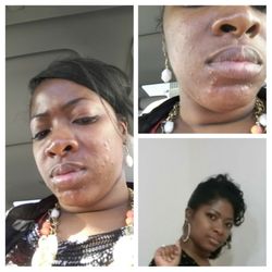 facials in memphis tn Facials in memphis tn
