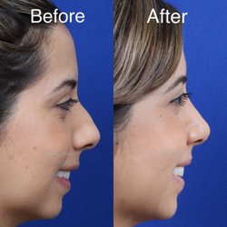 facial cosmedic surgery in denmark Escort lingum uk