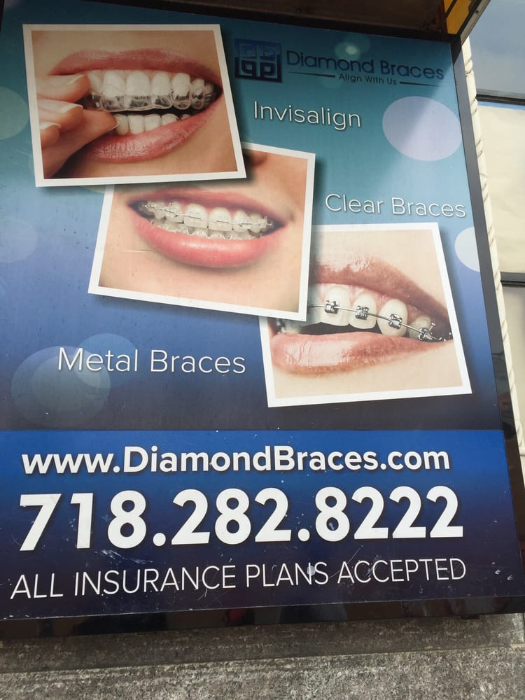 Diamond Braces 29 Photos & 14 Reviews Orthodontists 2848 Church