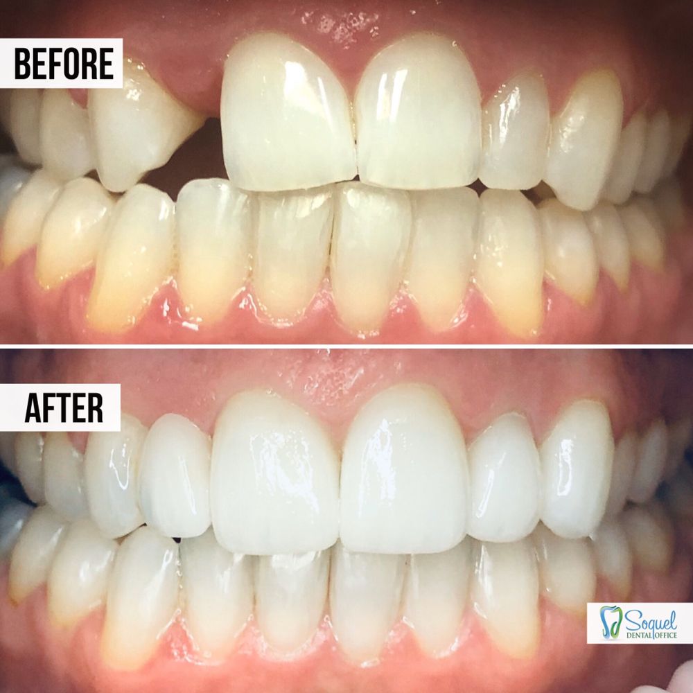 image of business Soquel Dental Office