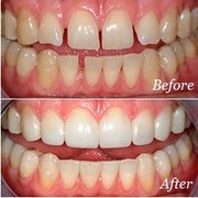 Torrado Dental General Dentistry 1655 Elmwood Ave Rochester Ny Photo Of Torrado Dental Rochester Ny United States