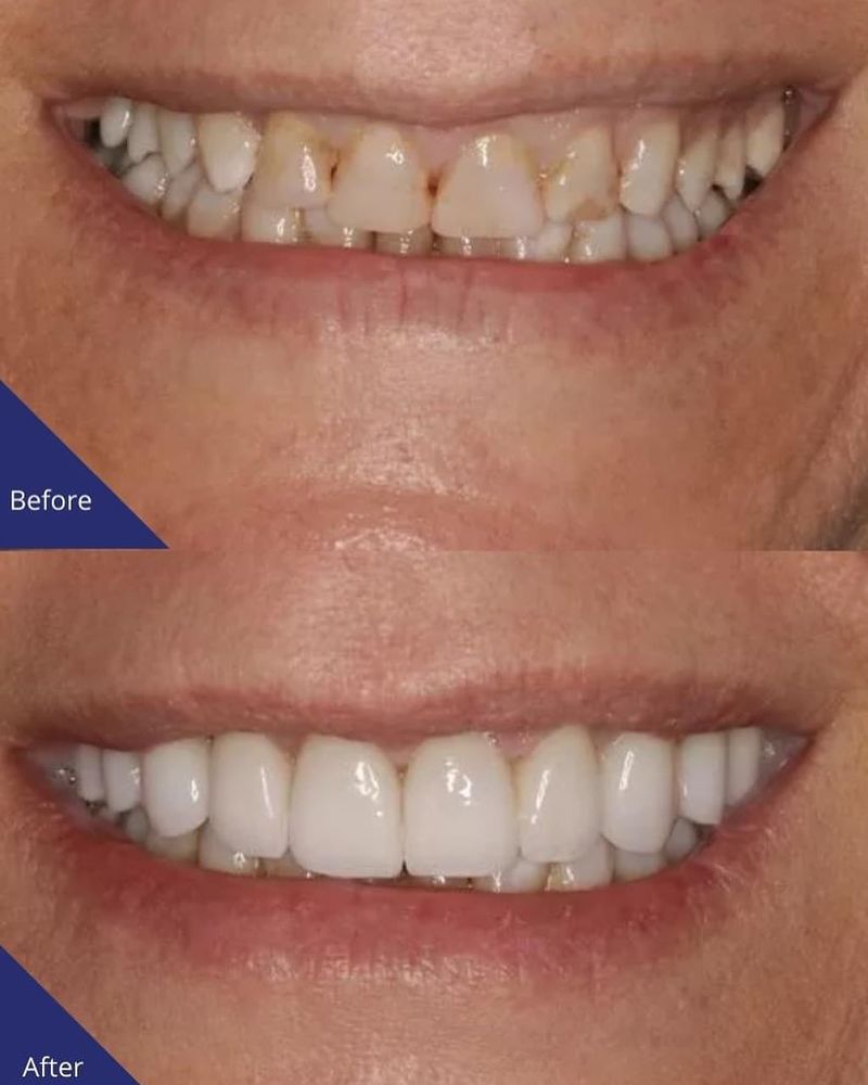 image of business Premier Smiles & Implant Dentistry