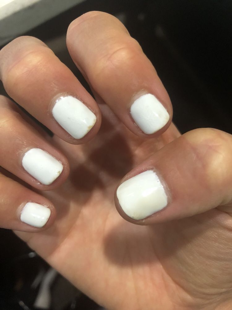 Why Does My White Gel Nail Polish Turn Yellow