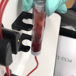 Sell your sperm sarasota images