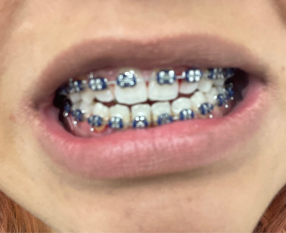 image of business Smiles West - Lynwood