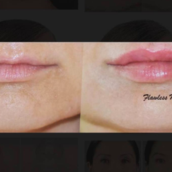 flawless med spa 11 photos 25 reviews medical spas 271 main