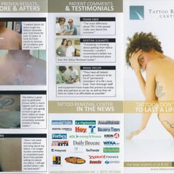 Photo Of Tattoo Removal Center Torrance Ca United States Tattoo Removal Center Photo Of Tattoo Removal Center Torrance Ca United States Tattoo Removal Center