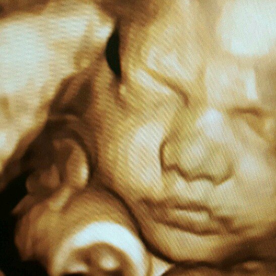 Sweet Baby Face 28 Photos &amp; 10 Reviews Ultrasound