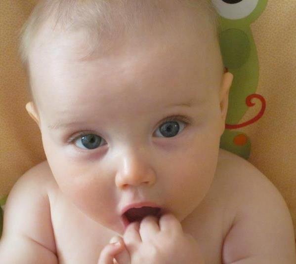 Pediatric Eye MD 15 Reviews Ophthalmologists 19213 Union